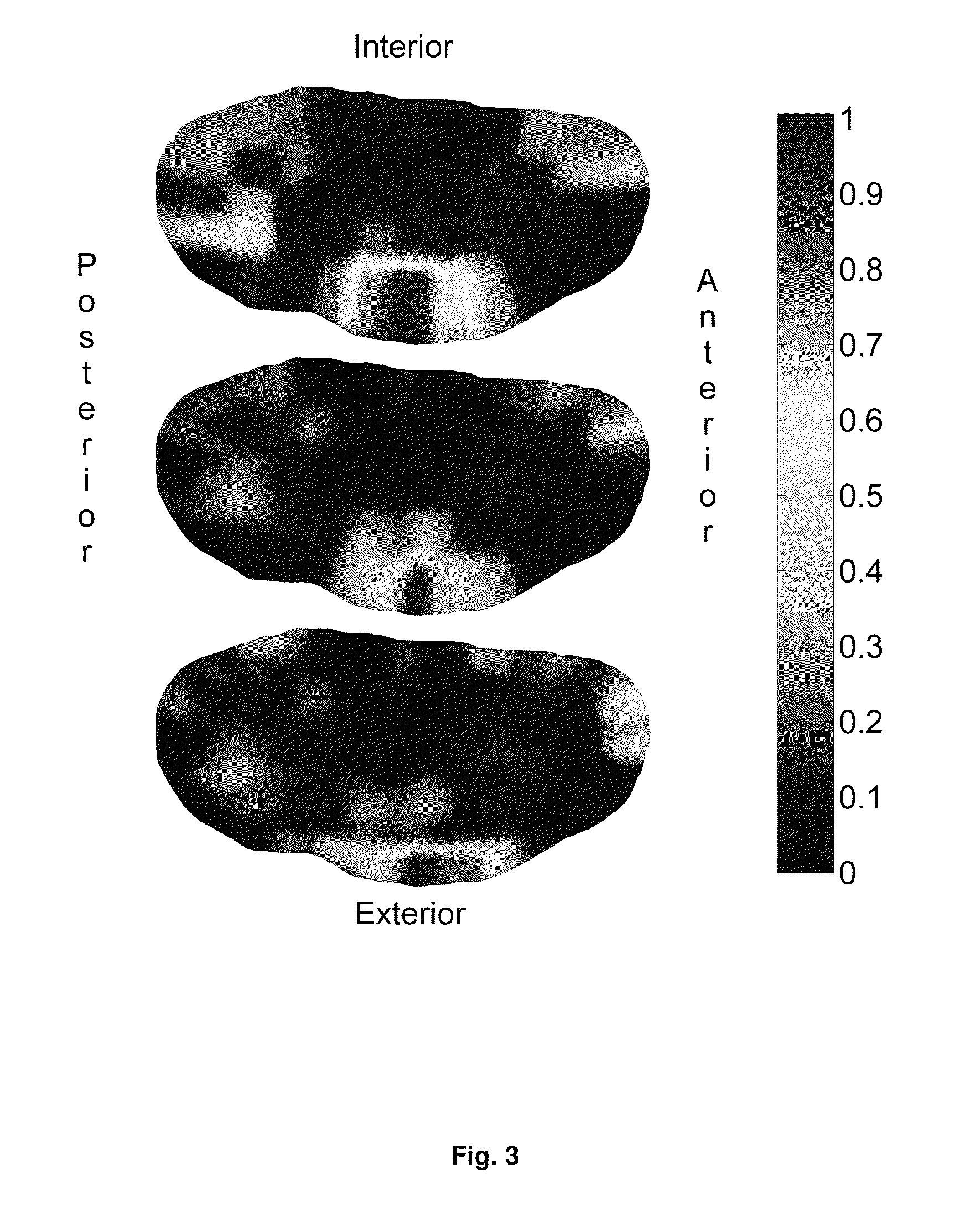 Optimised region of interest selection