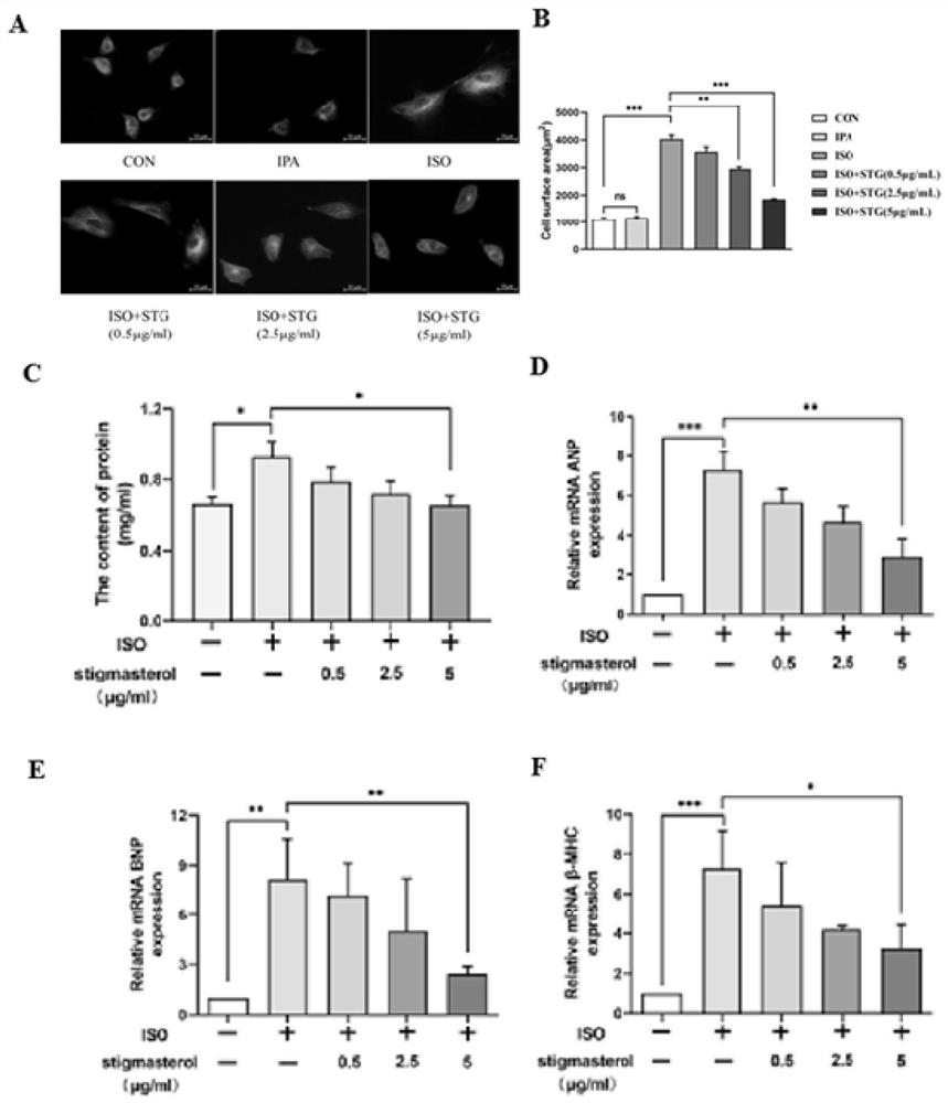 Application of stigmasterol to preparation of medicine for improving cardiac hypertrophy