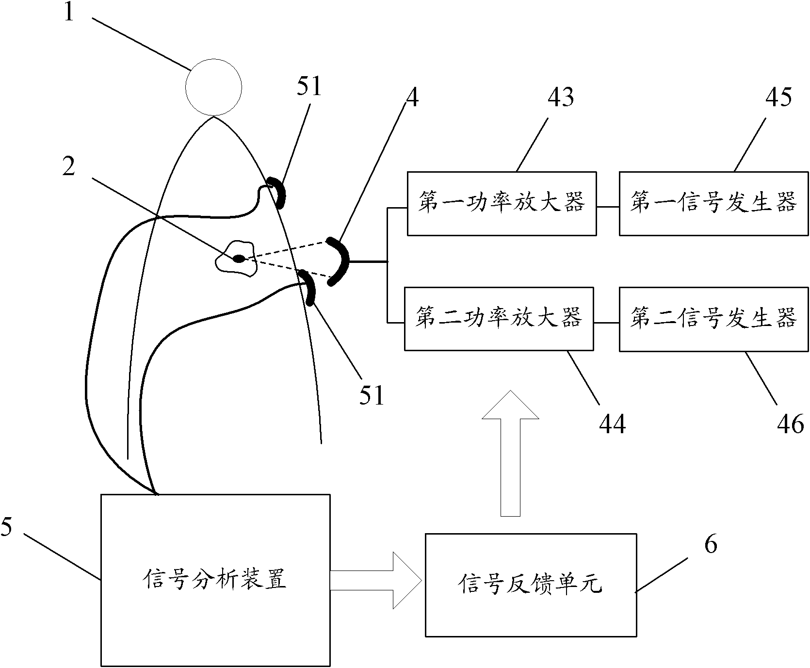 Double-frequency focused ultrasound system