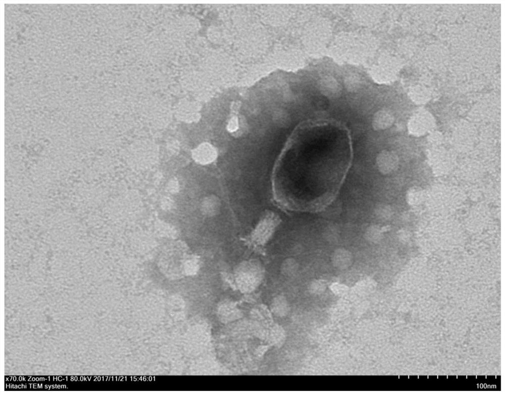 Lyoprotectant for Klebsiella pneumoniae phage, preparation method and application thereof