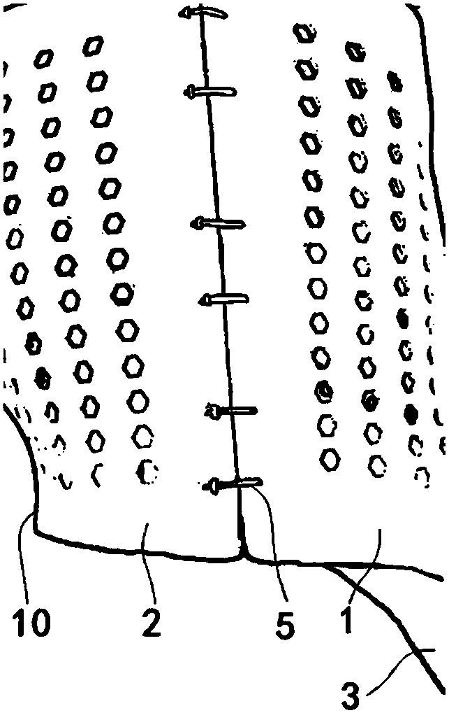 Nighttime human scoliosis orthopedic support and design method thereof