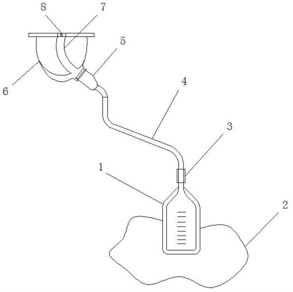 Urology catheter support device