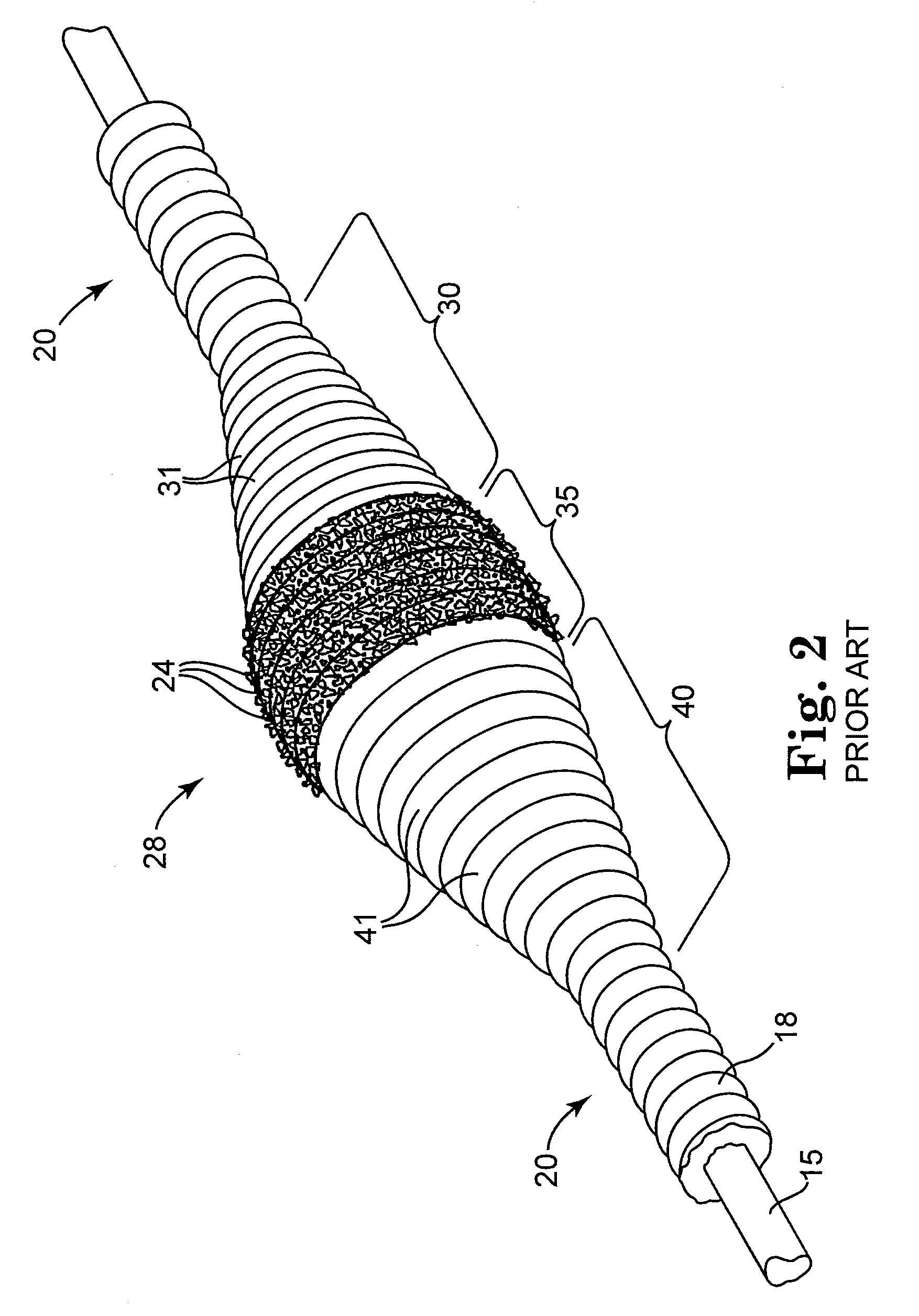 Cleaning apparatus and method for high-speed rotational atherectomy devices