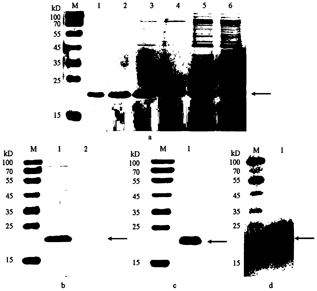 Method of obtaining human recombinant fibronectin by utilizing genetic engineering