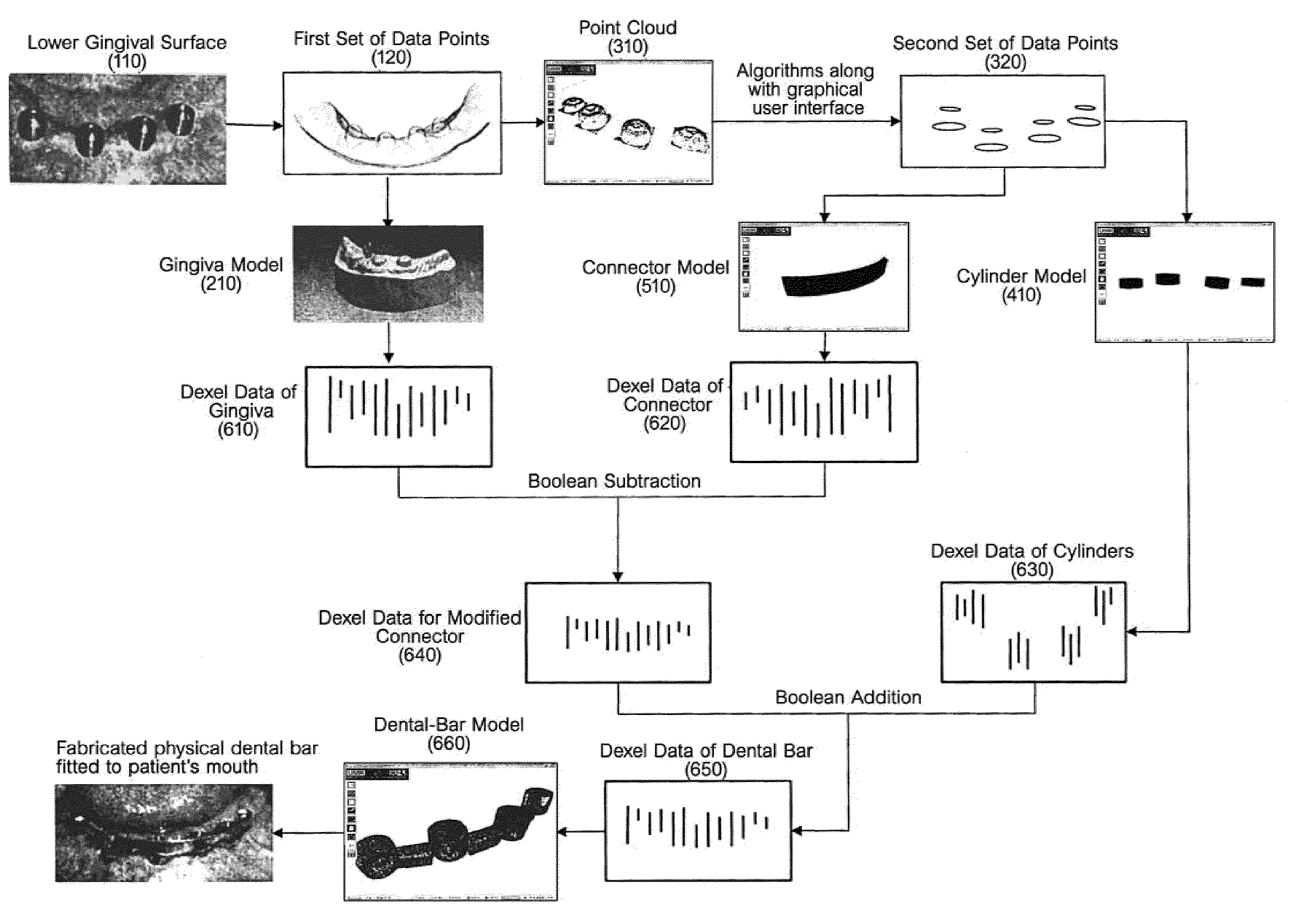 Computer aided dental bar design