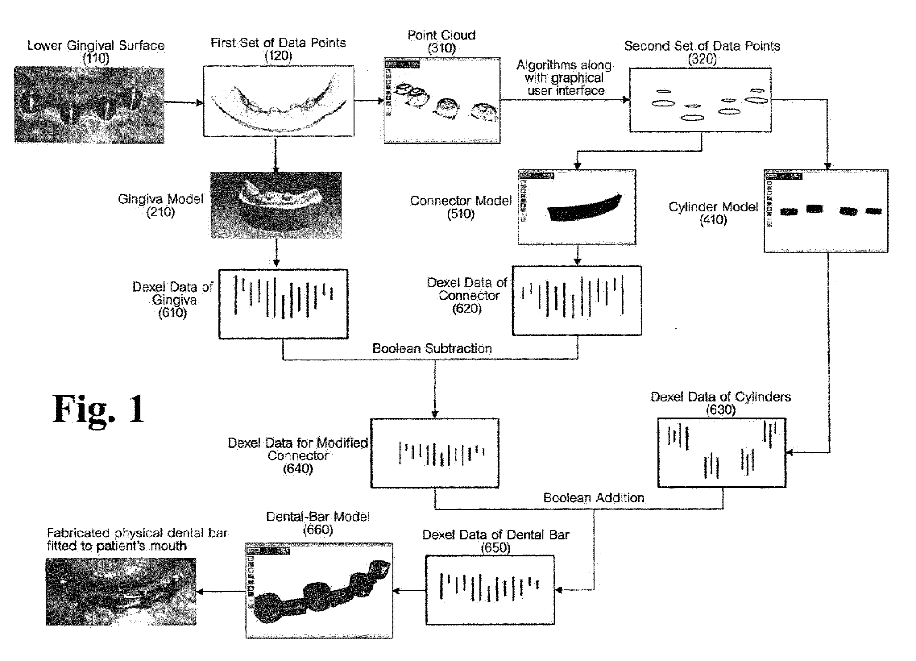 Computer aided dental bar design