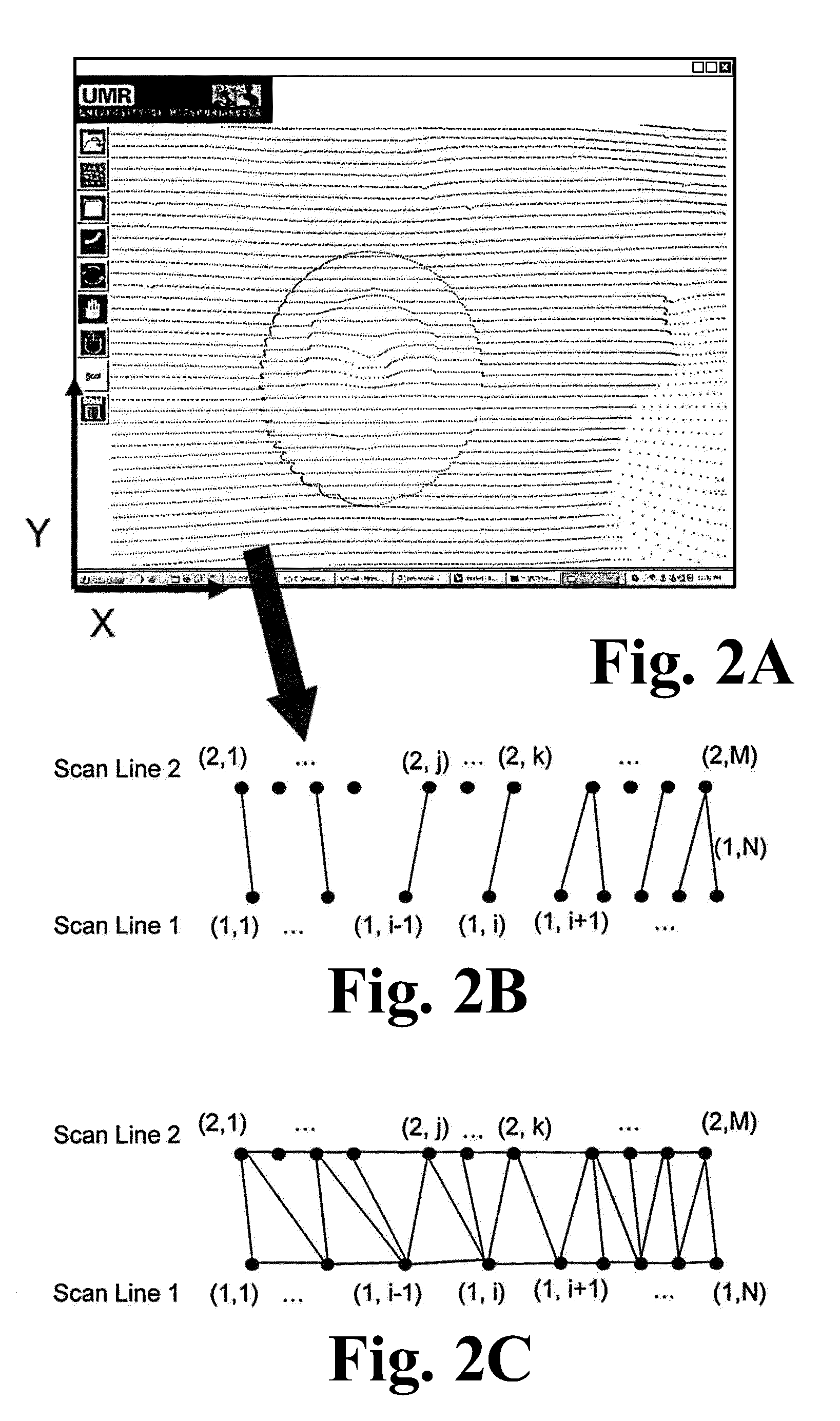 Computer aided dental bar design