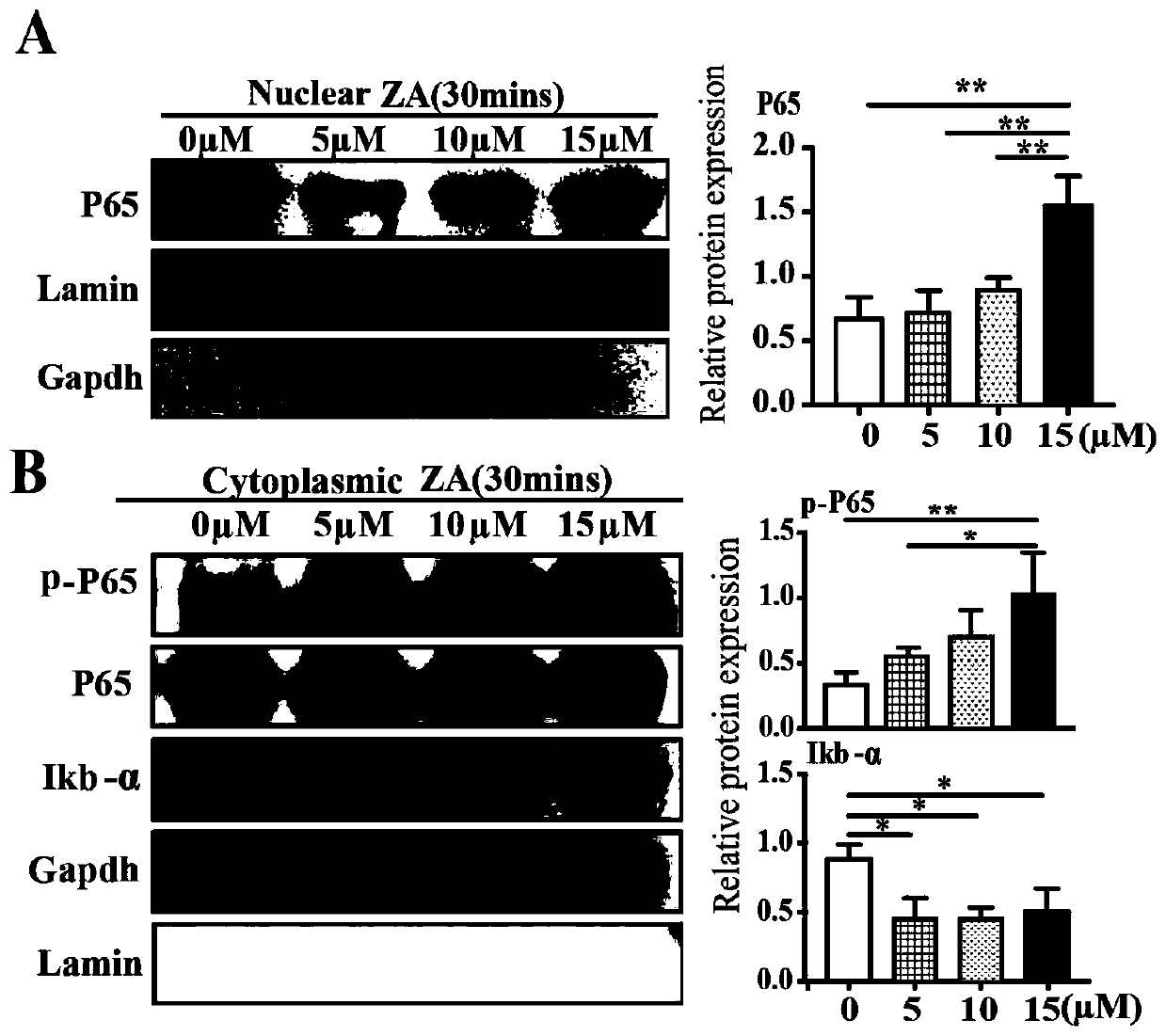 Application of TLR4 inhibitor in preparation of medicament for treating tooth extraction wound healing disorder caused by bisphosphonate-related osteonecrosis of the jaw (BRONJ)