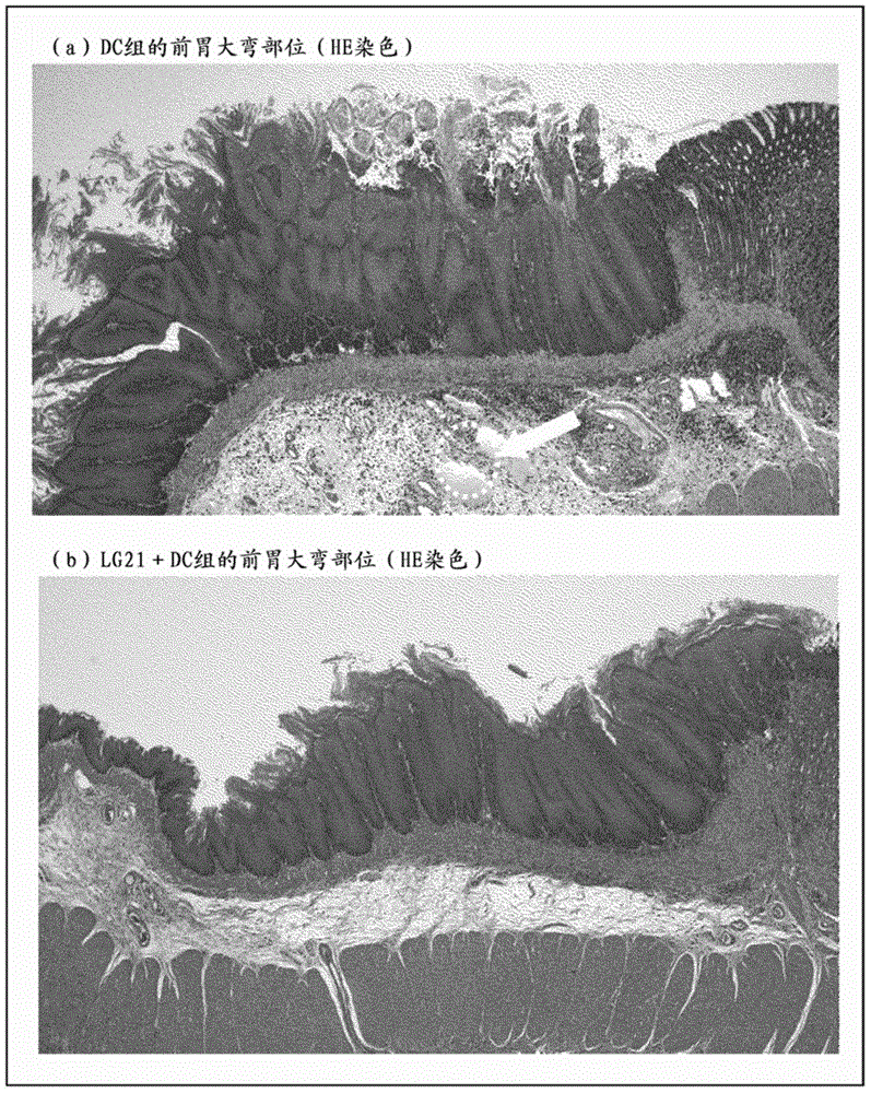 Prophylactic agent for squamous carcinoma, squamous carcinoma model anima, and method for producing said model animal