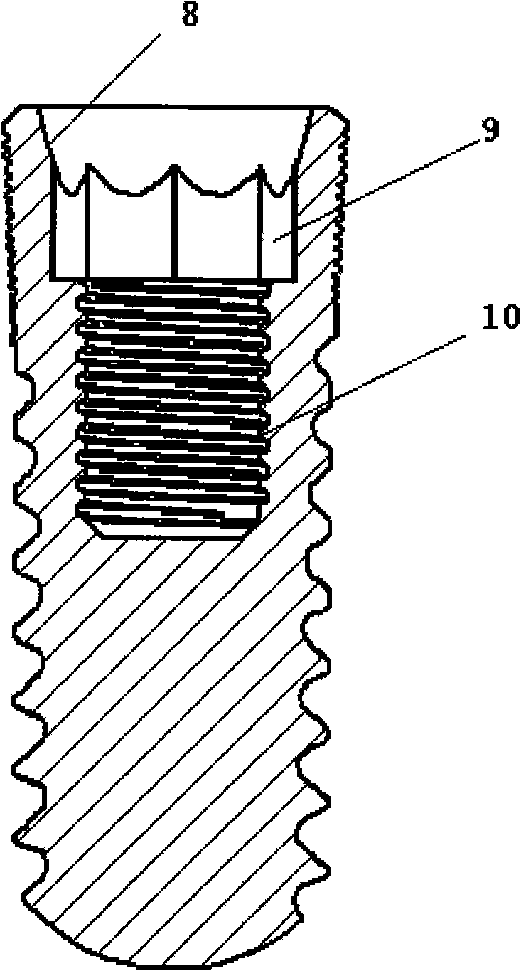 Screw thread planting body