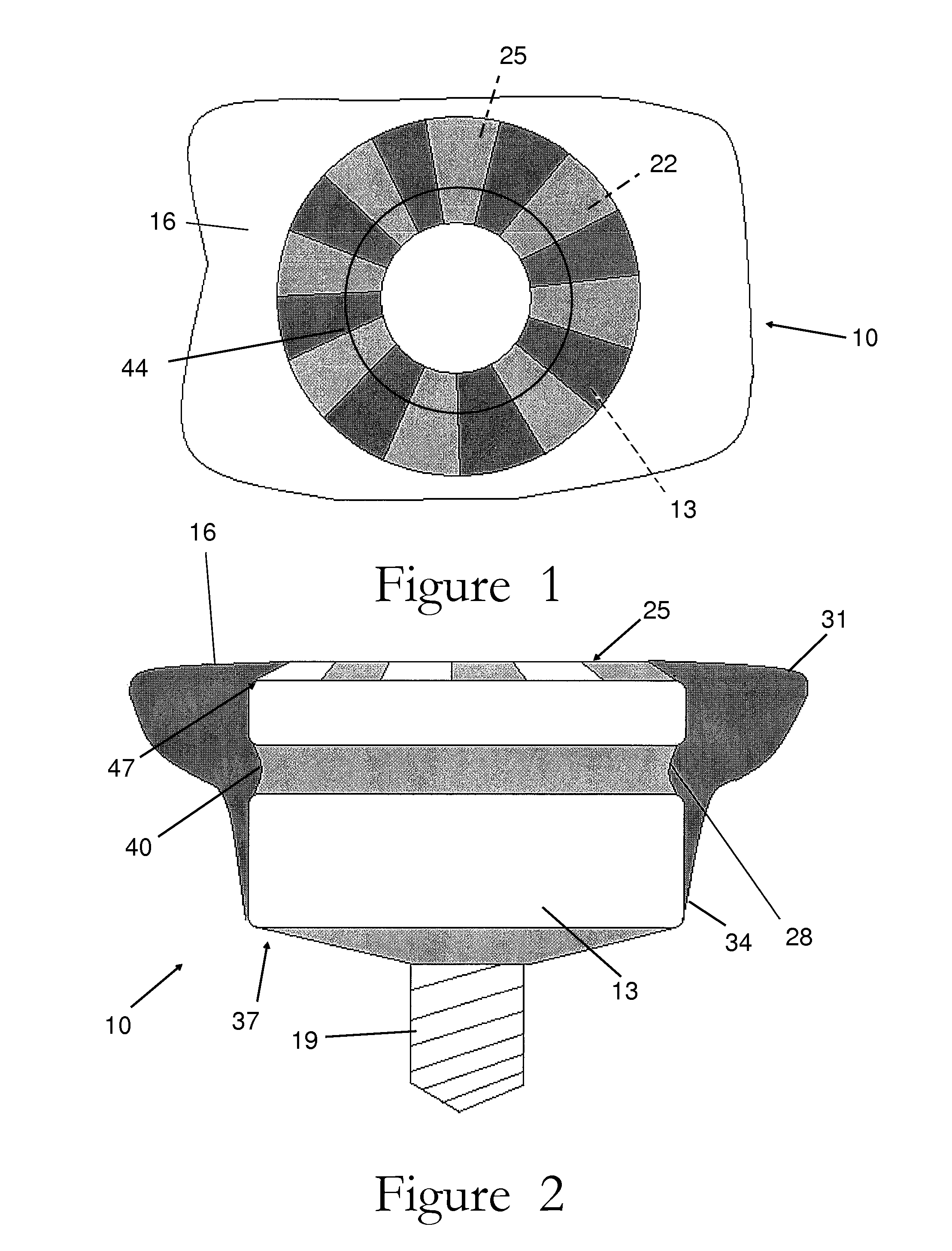 Snap-on two-piece emergence profile healing abutment