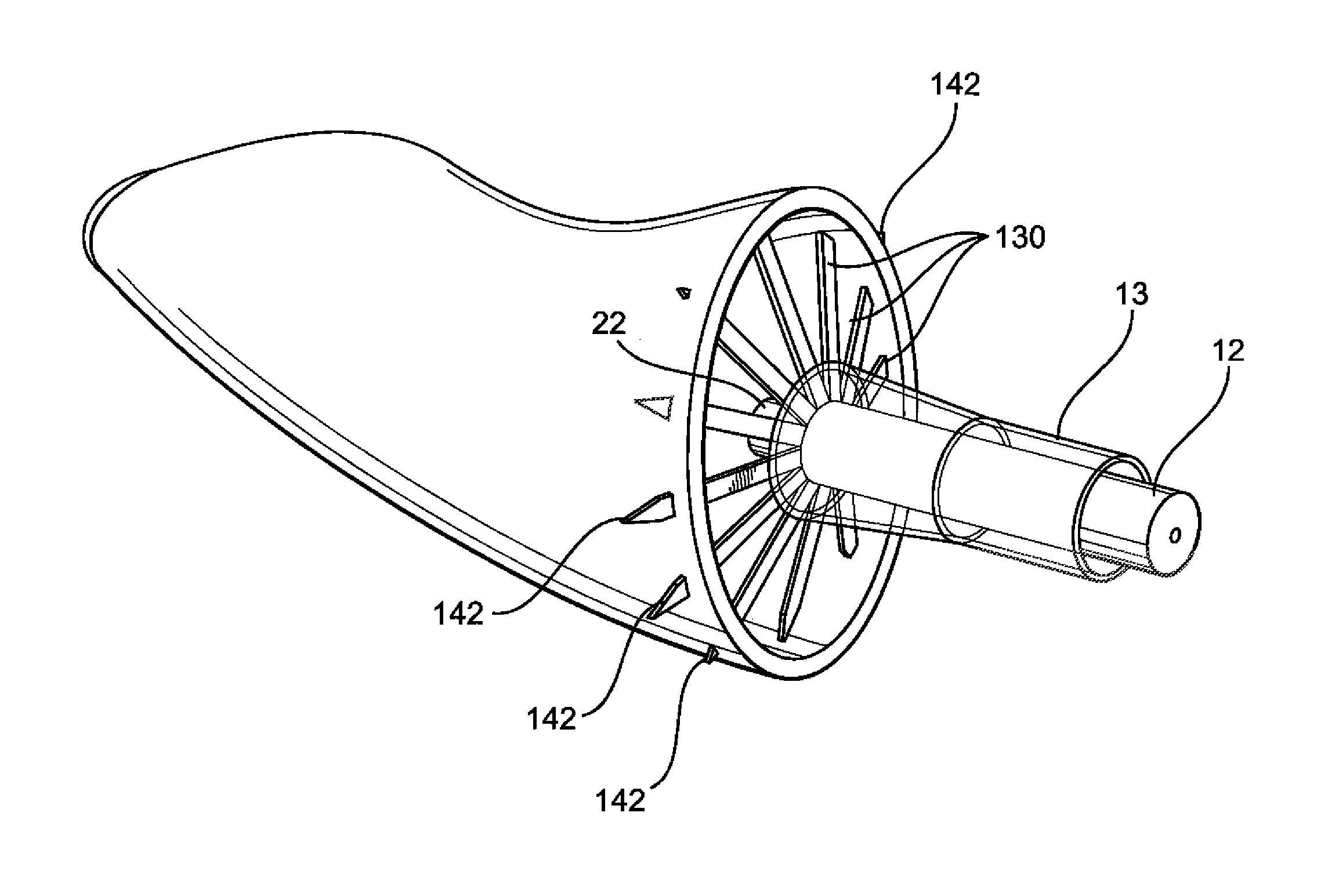 Assembly and method for left atrial appendage occlusion