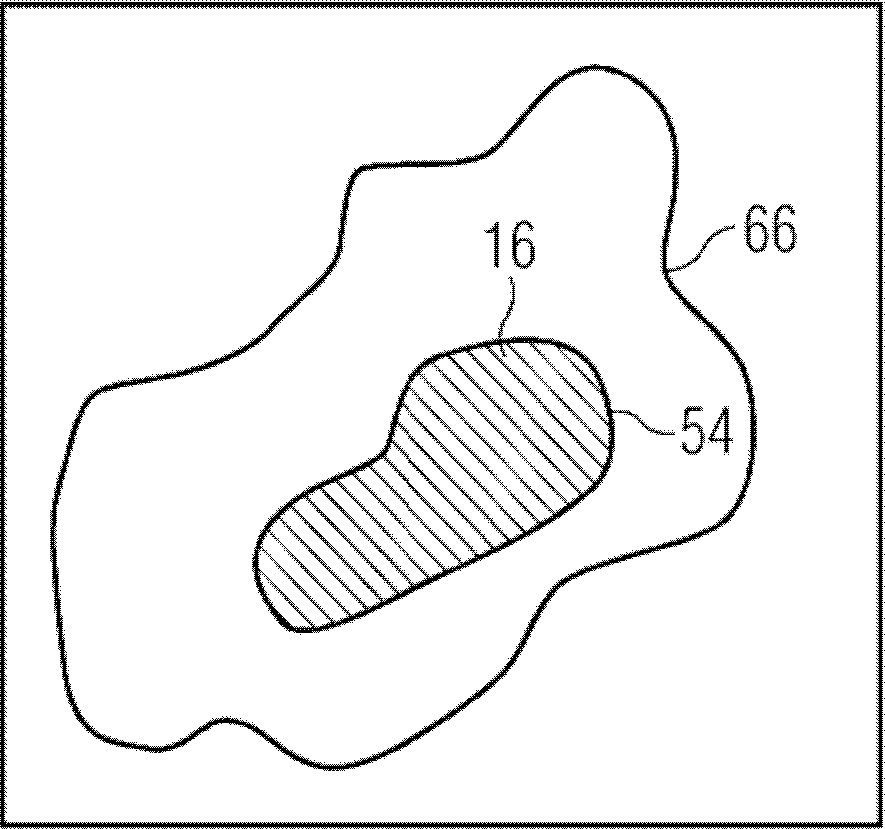 Method, image processing device and computed tomography system for determining a proportion of necrotic tissue