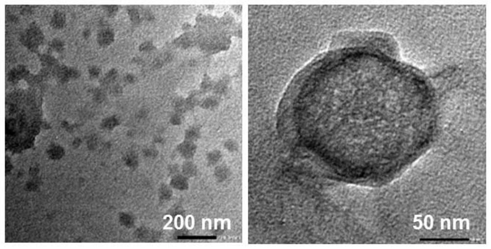 A kind of mofs nano drug carrier coated with red blood cell membrane and its preparation method and application