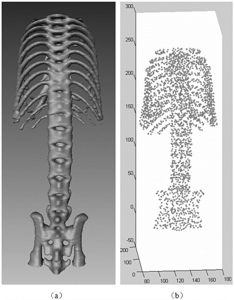 Organ auxiliary positioning segmentation method based on statistical deformation model