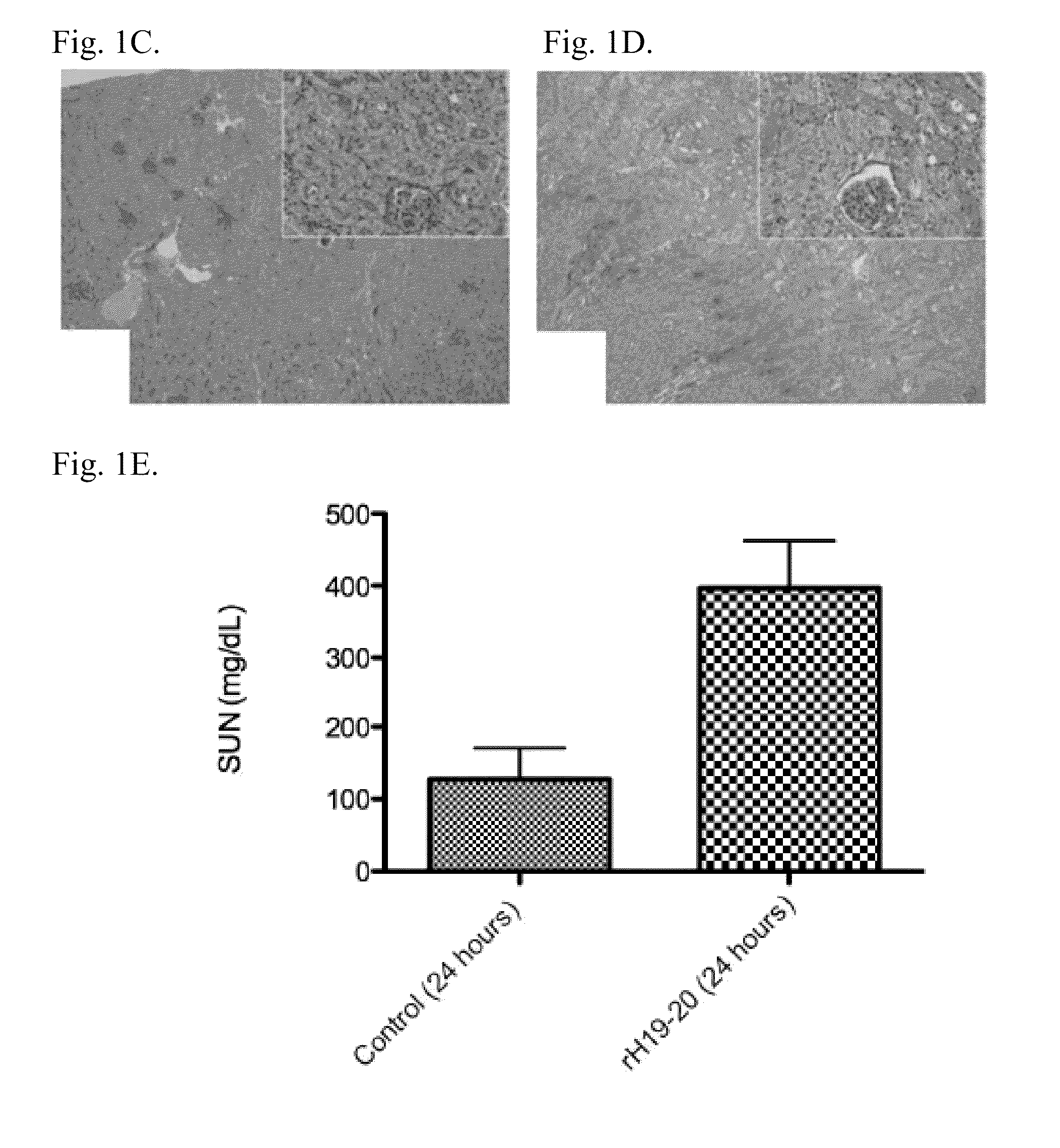 Modulating the Alternative Complement Pathway