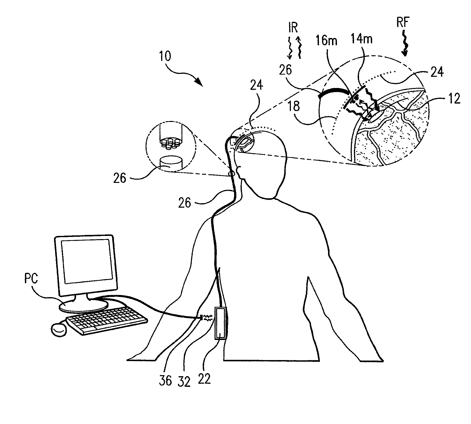 Wireless system for epilepsy monitoring and measurement