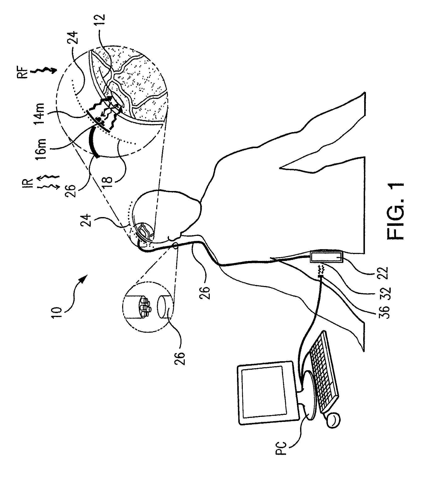 Wireless system for epilepsy monitoring and measurement