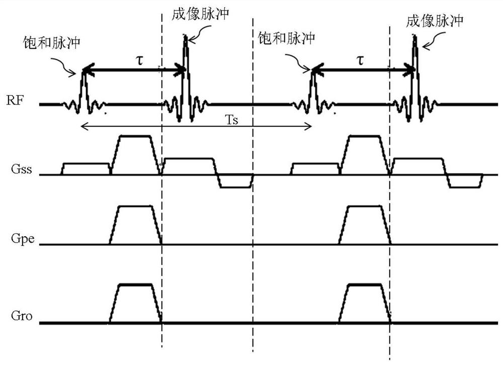 Magnetic resonance imaging method and magnetic resonance system