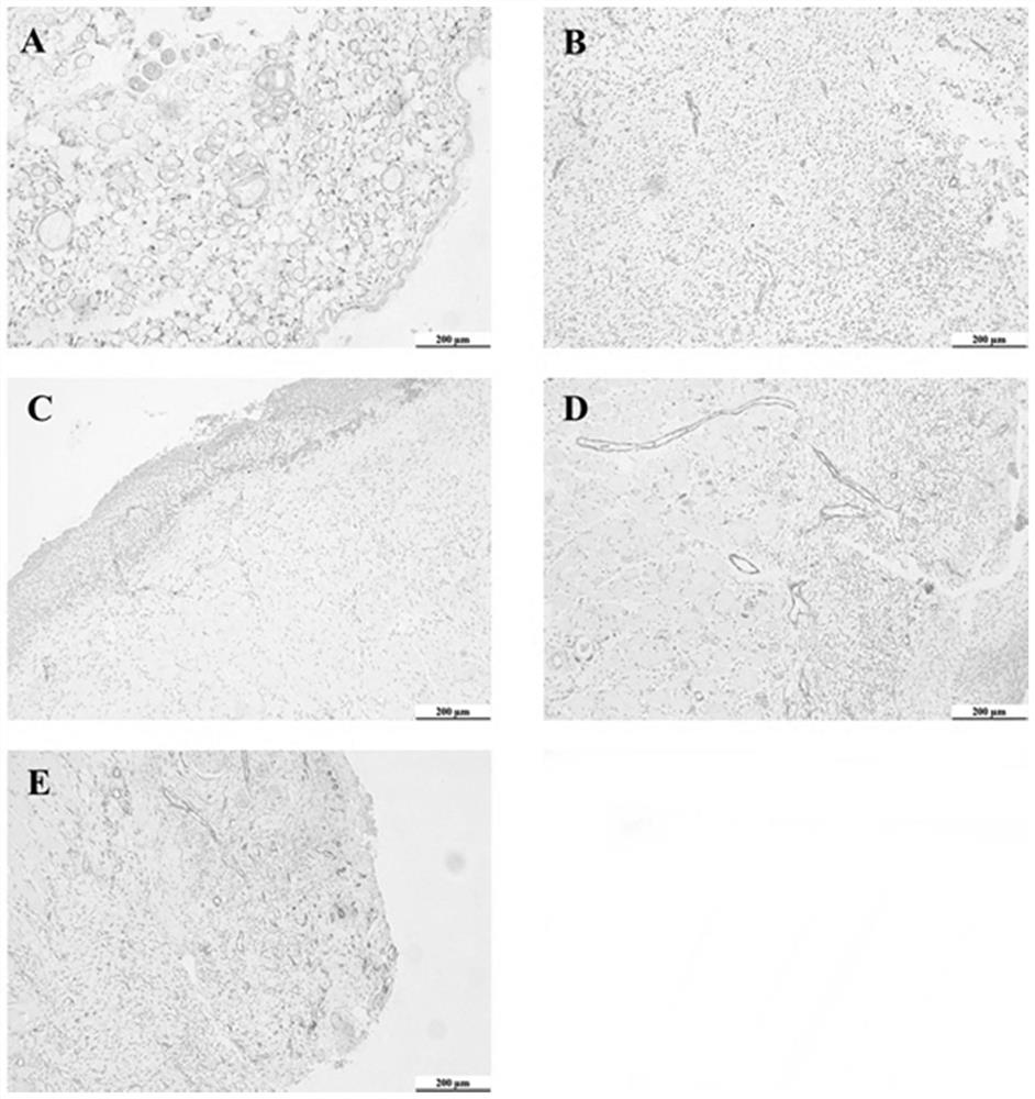 Traditional Chinese medicine compound external preparation for treating chronic wounds as well as preparation process and use method of traditional Chinese medicine compound external preparation