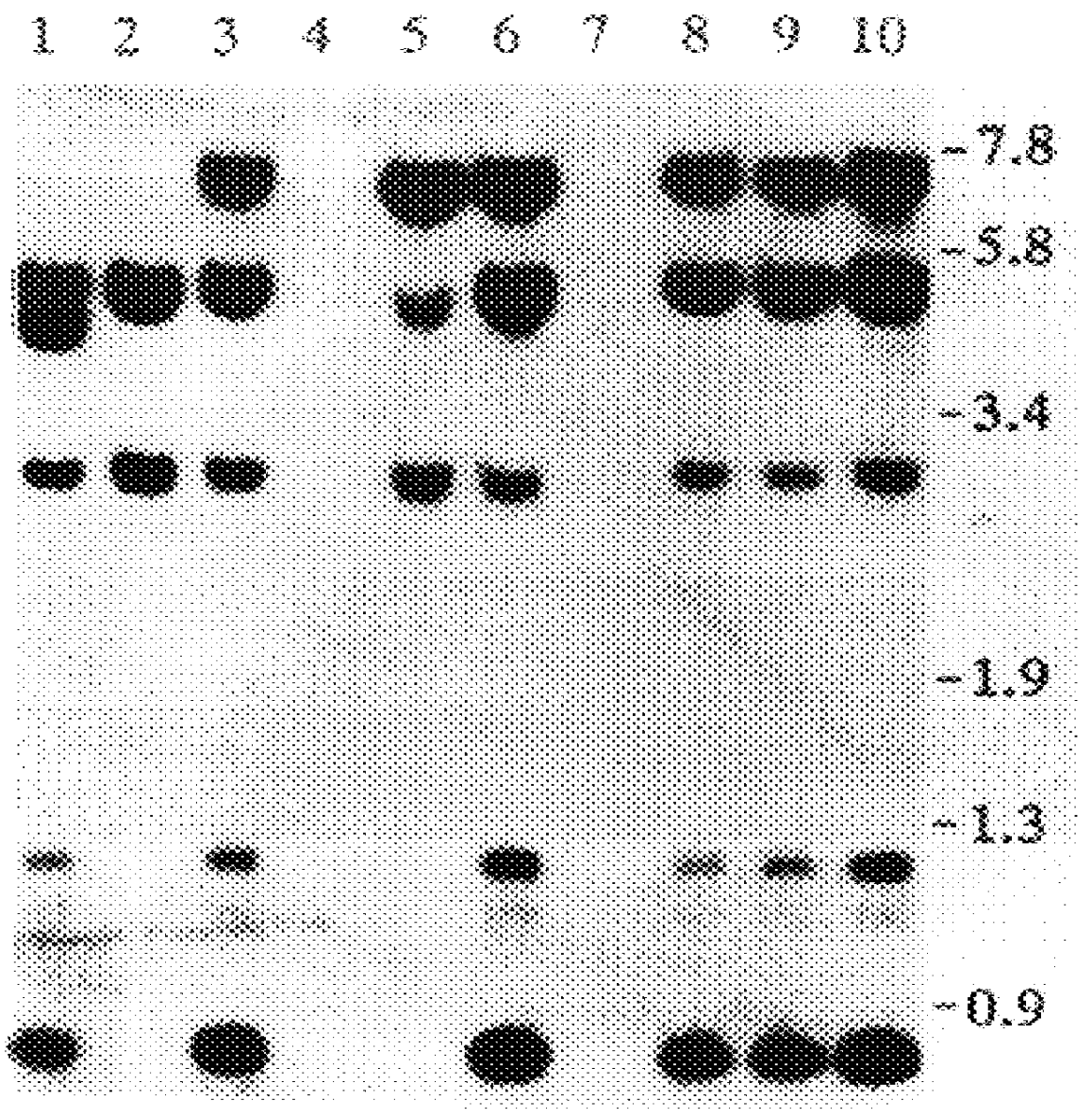 Glycosylation variants of iduronate 2-sulfatase