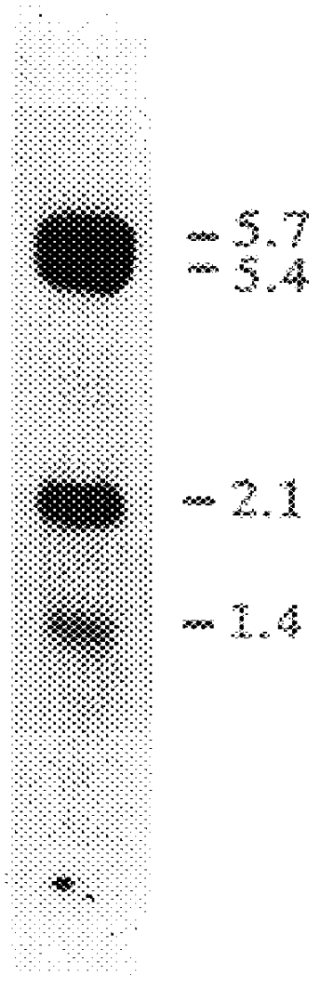 Glycosylation variants of iduronate 2-sulfatase