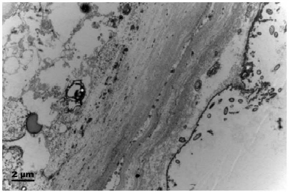 Preparation method of protozoa cyst transmission electron microscope sample