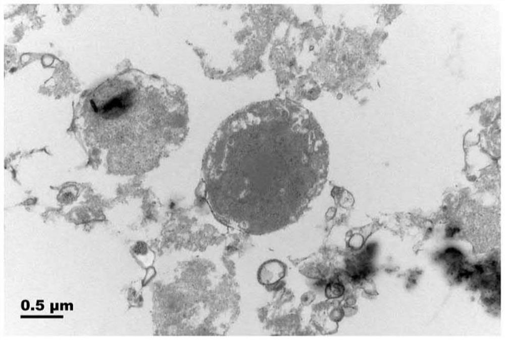 Preparation method of protozoa cyst transmission electron microscope sample