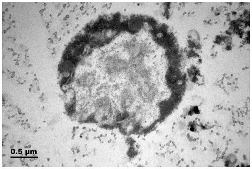 Preparation method of protozoa cyst transmission electron microscope sample