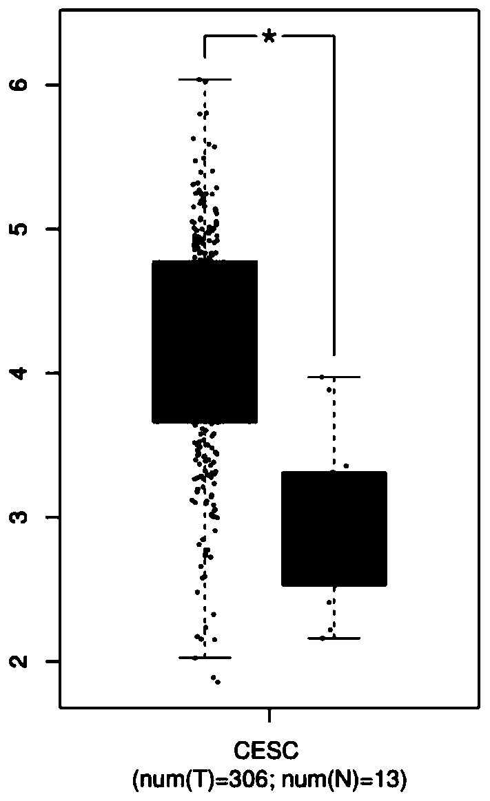 Human GPD2 gene inhibitor and application thereof