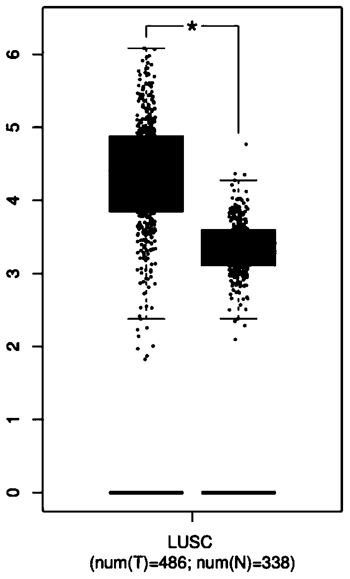 Human GPD2 gene inhibitor and application thereof