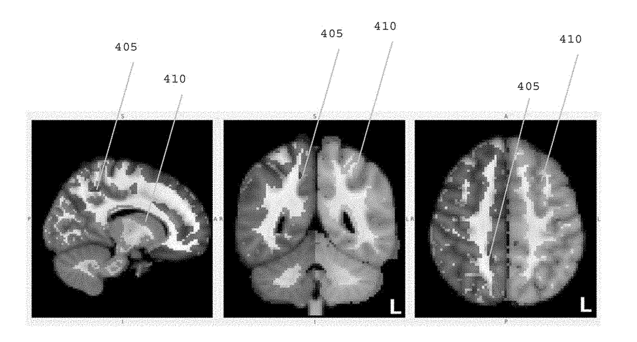 System, method and computer-accessible medium for diffusion imaging acquisition and analysis