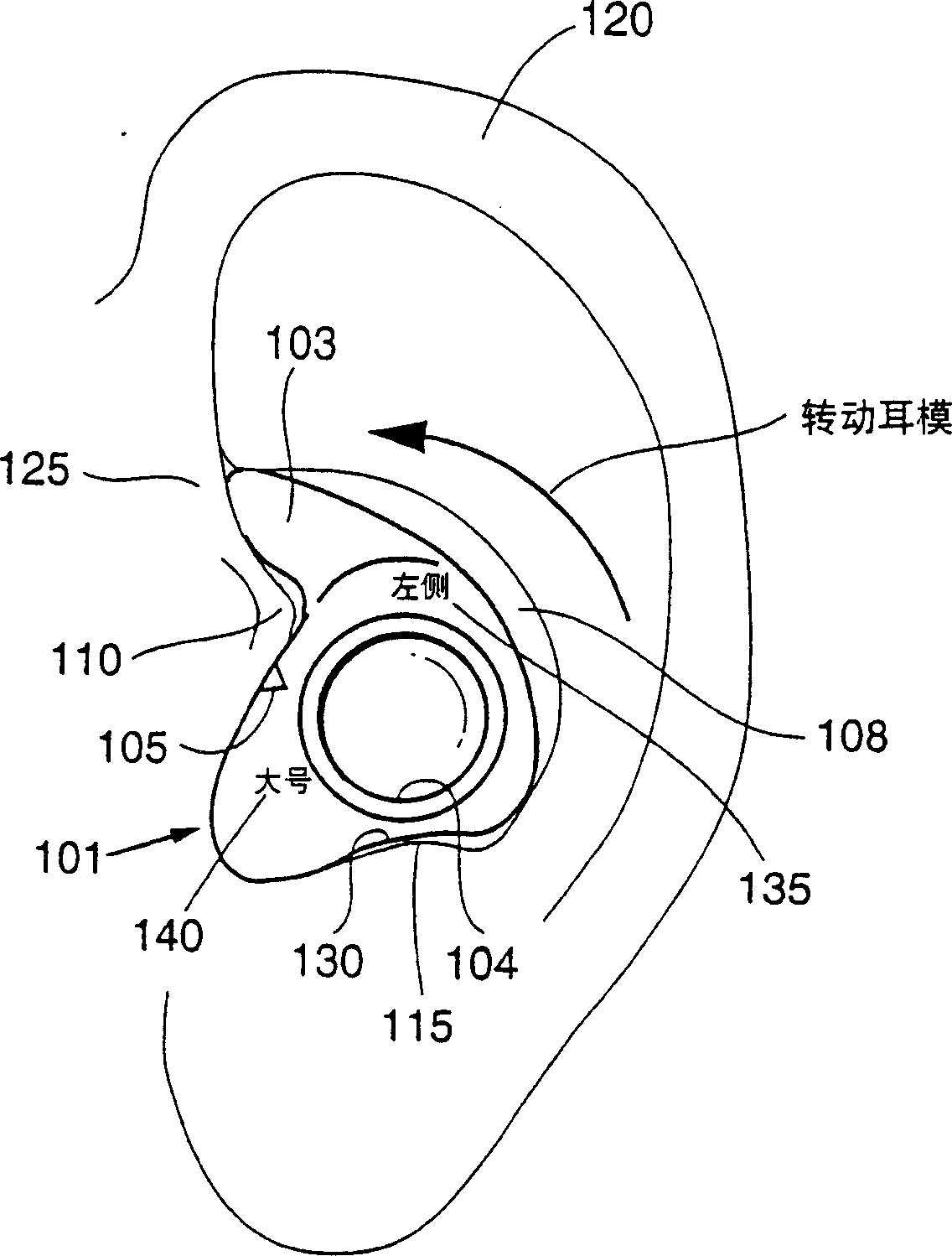 Retained ear mould for improving combination device