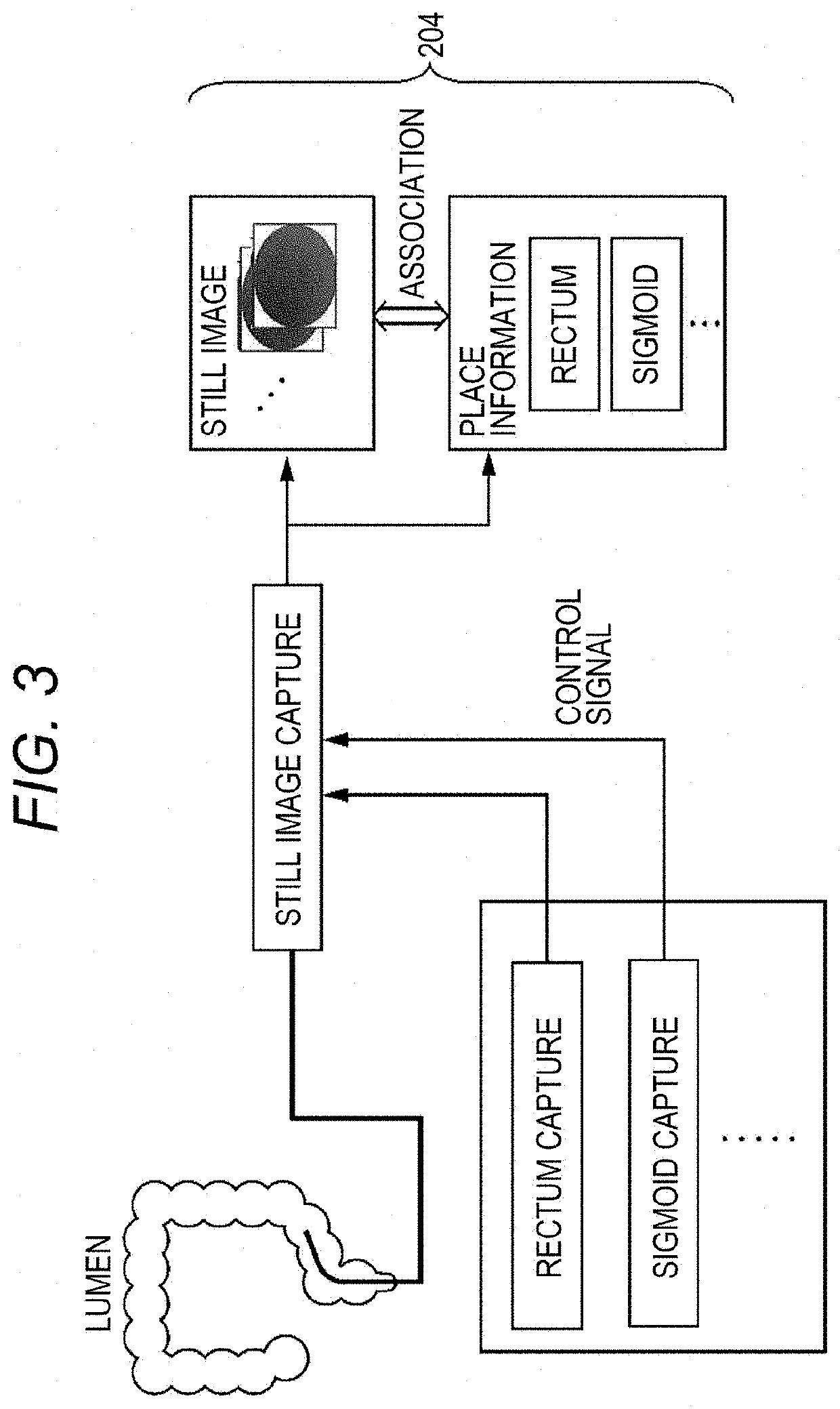 Electronic endoscope system