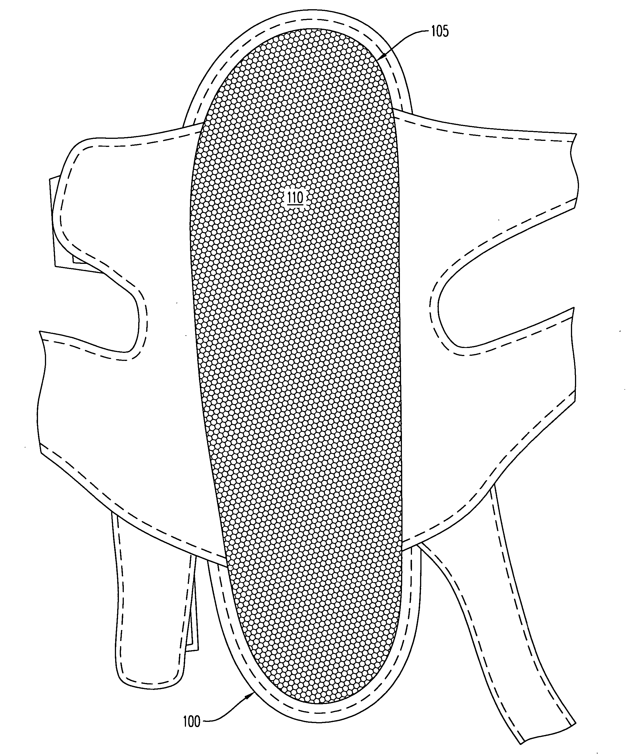 Method to capture and support a 3-D contour