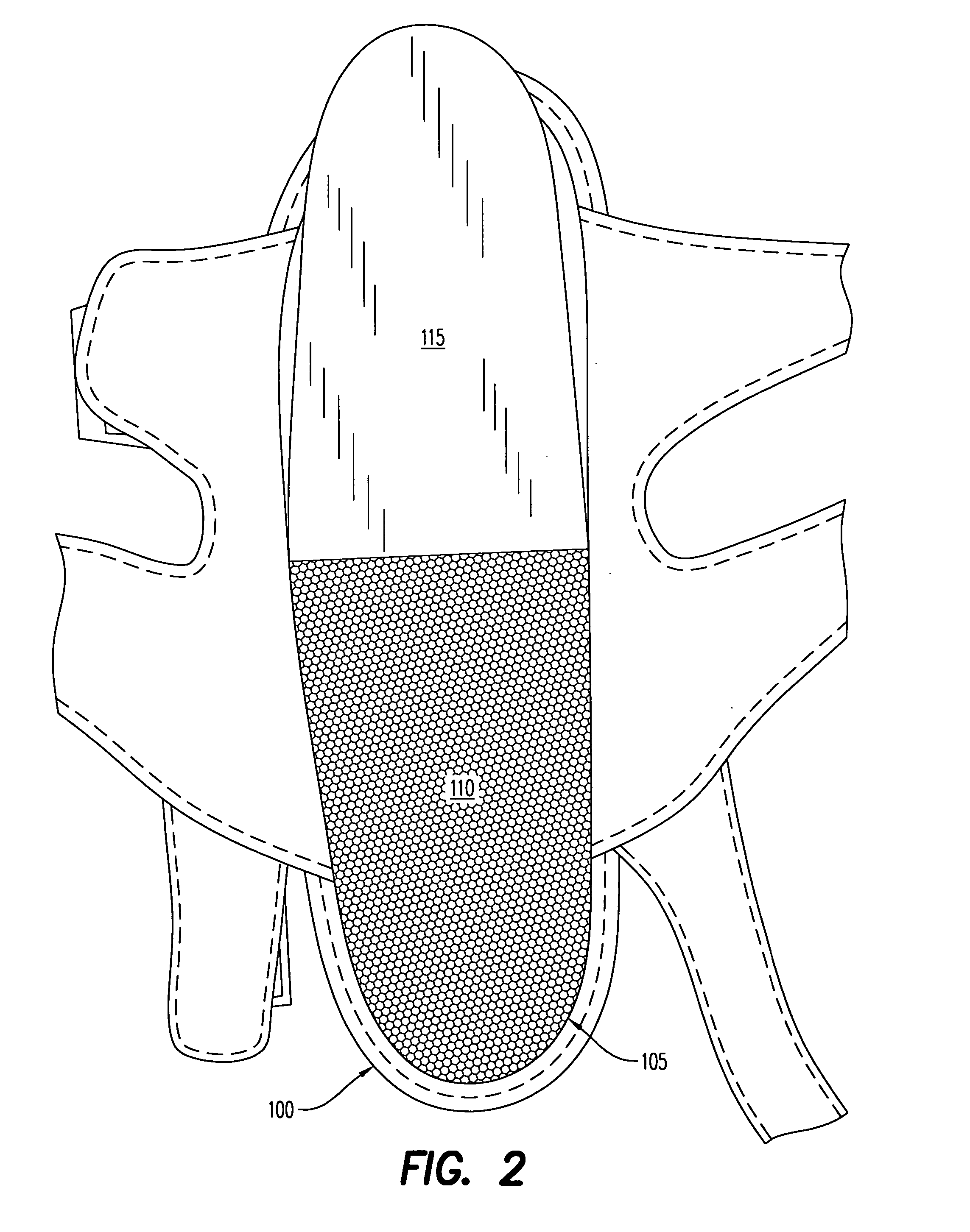 Method to capture and support a 3-D contour