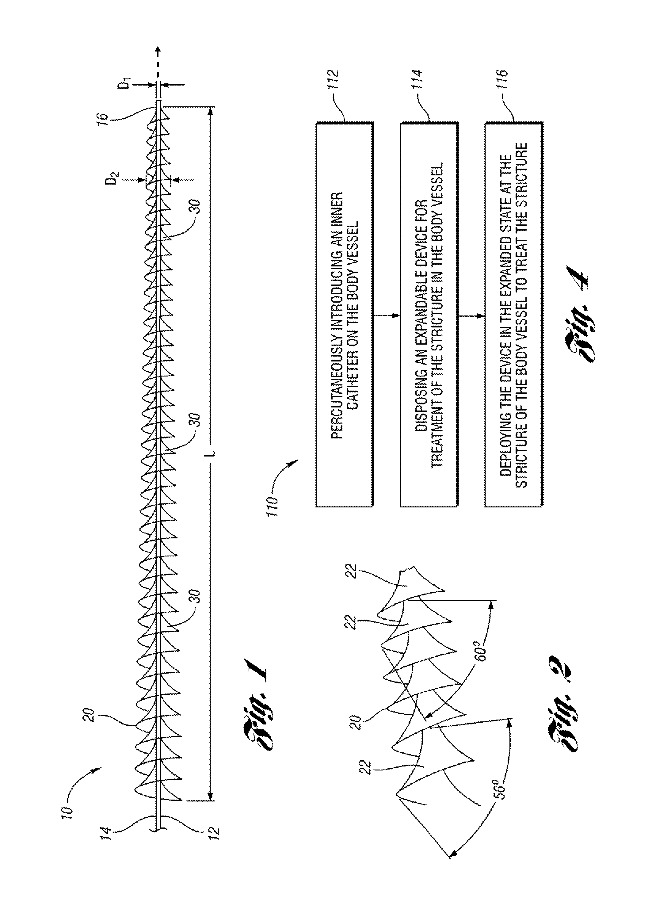 Expandable device for treatment of a stricture in a body vessel