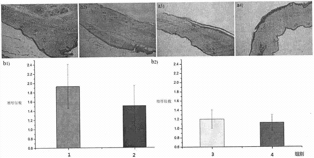 P-oxanone and L-phenylalanine copolymer and application thereof