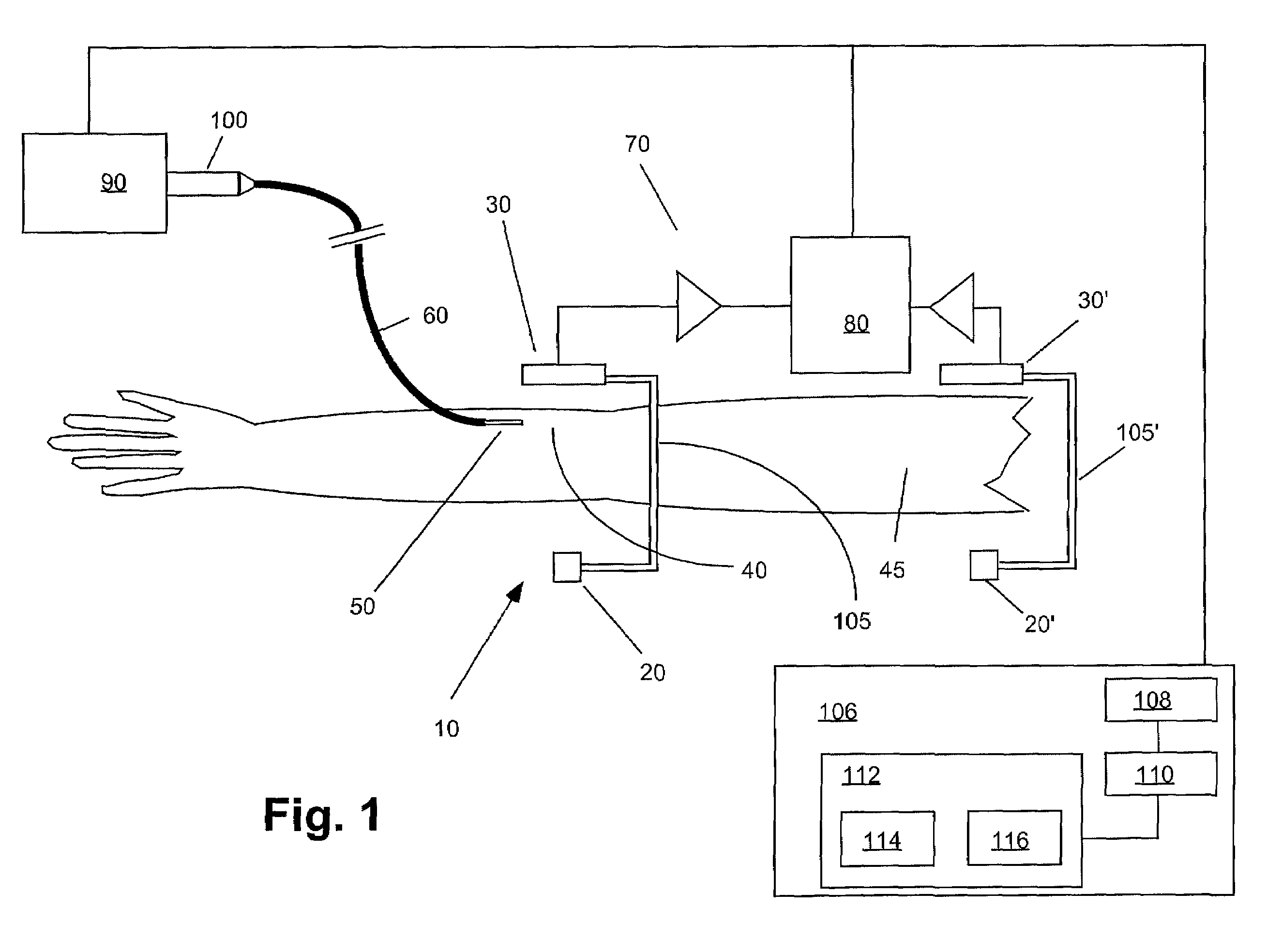 Apparatuses, systems and methods for extravasation detection