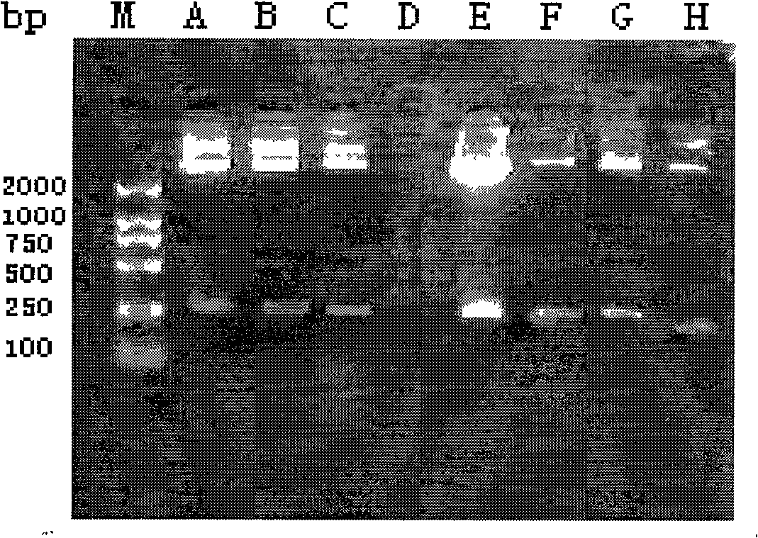 SiRNA inhibiting toxoplasma gondii wx2 gene expression and use thereof