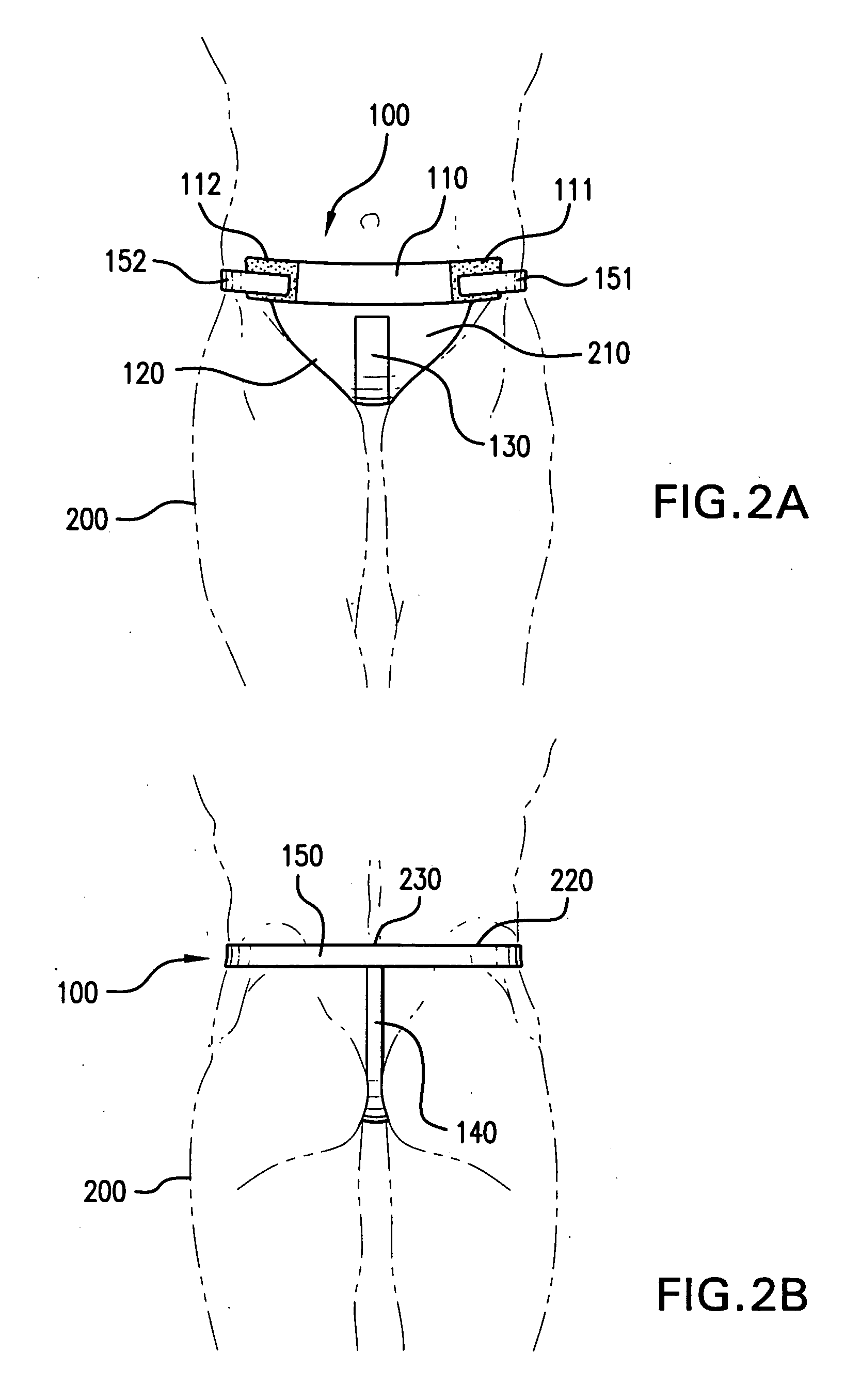 Easy on-off device to support and change absorption pads for patients suffering from incontinence