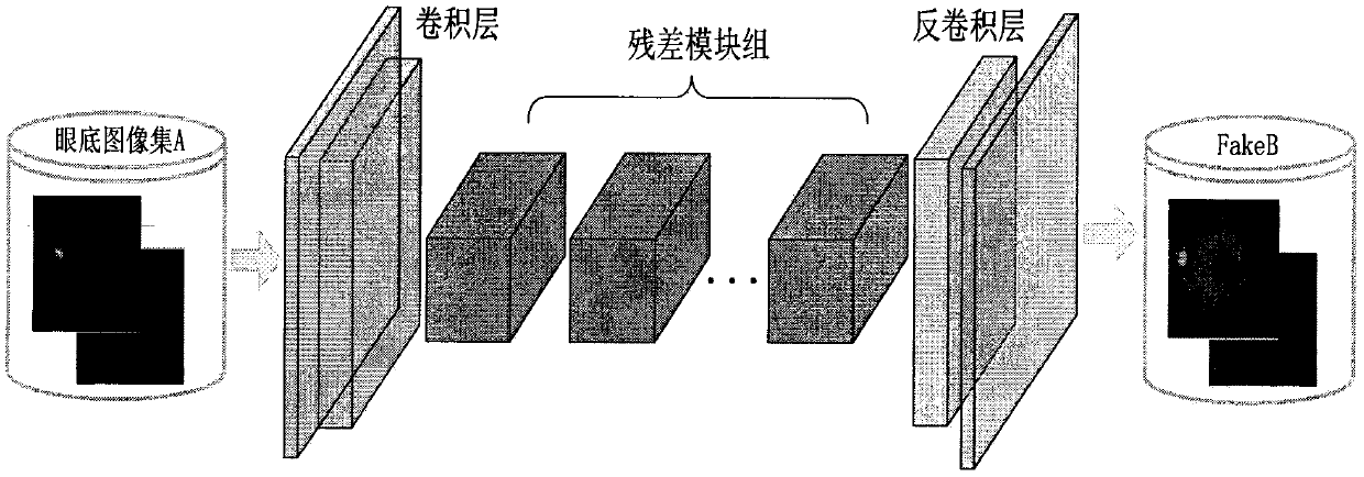 Fundus image enhancement method based on generative adversarial network