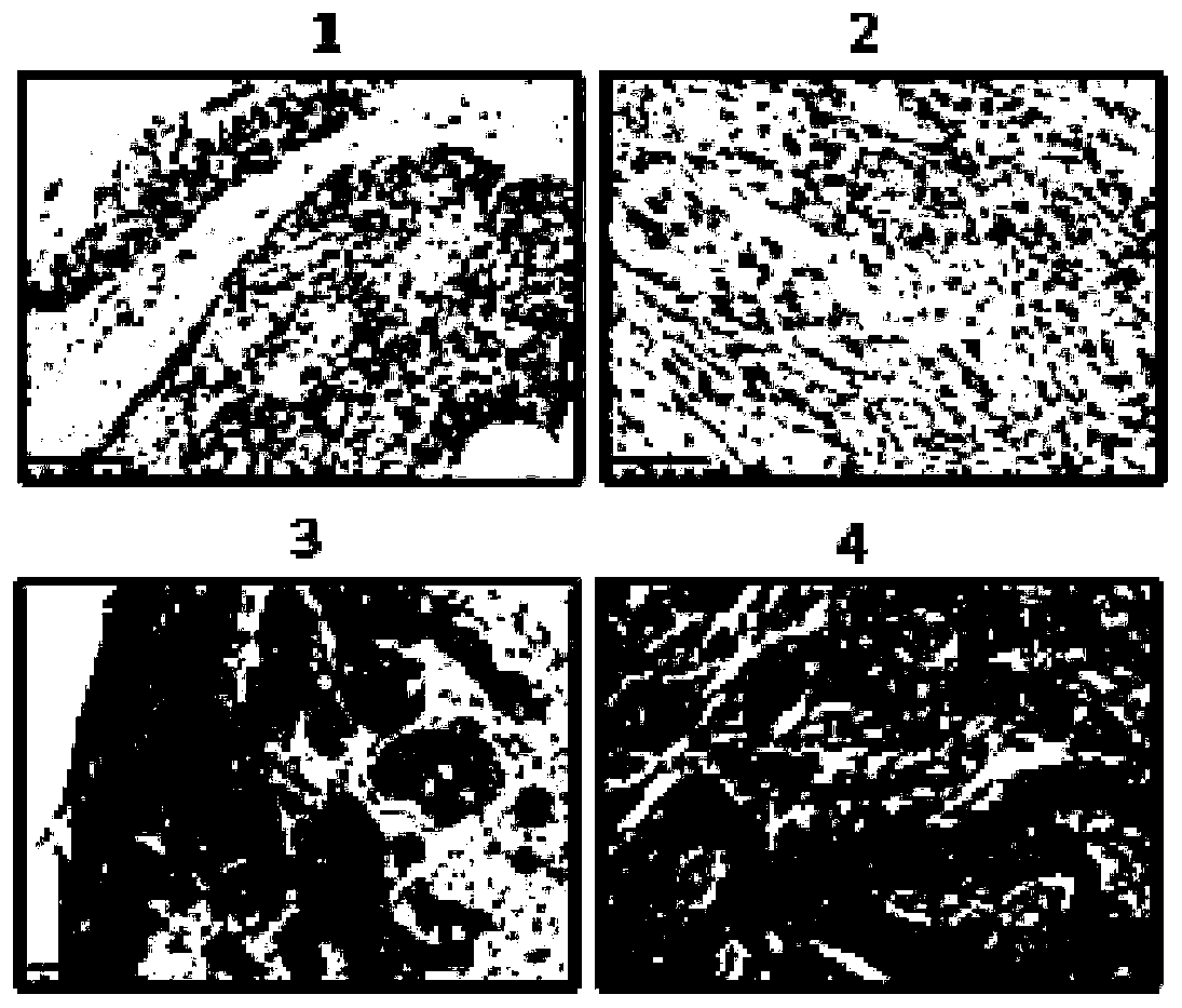 A biomarker for esophageal cancer and its application