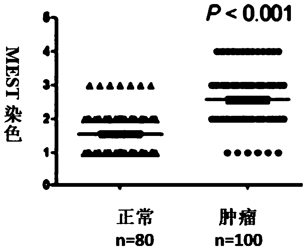 A biomarker for esophageal cancer and its application