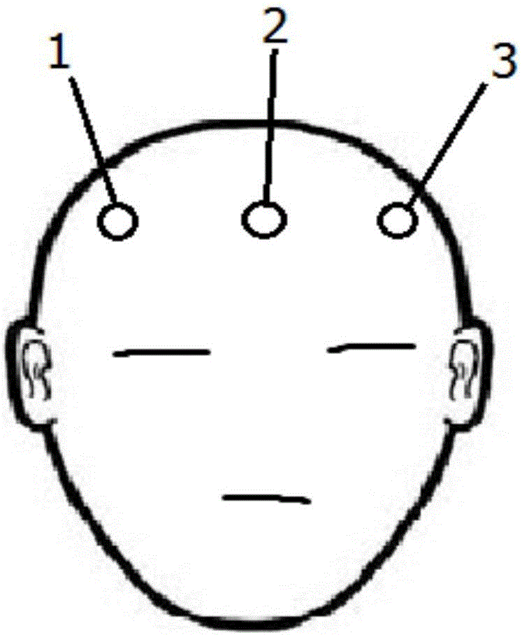 Electroencephalogram-based wearable anti-fatigue intelligent monitoring and pre-warning system for driver