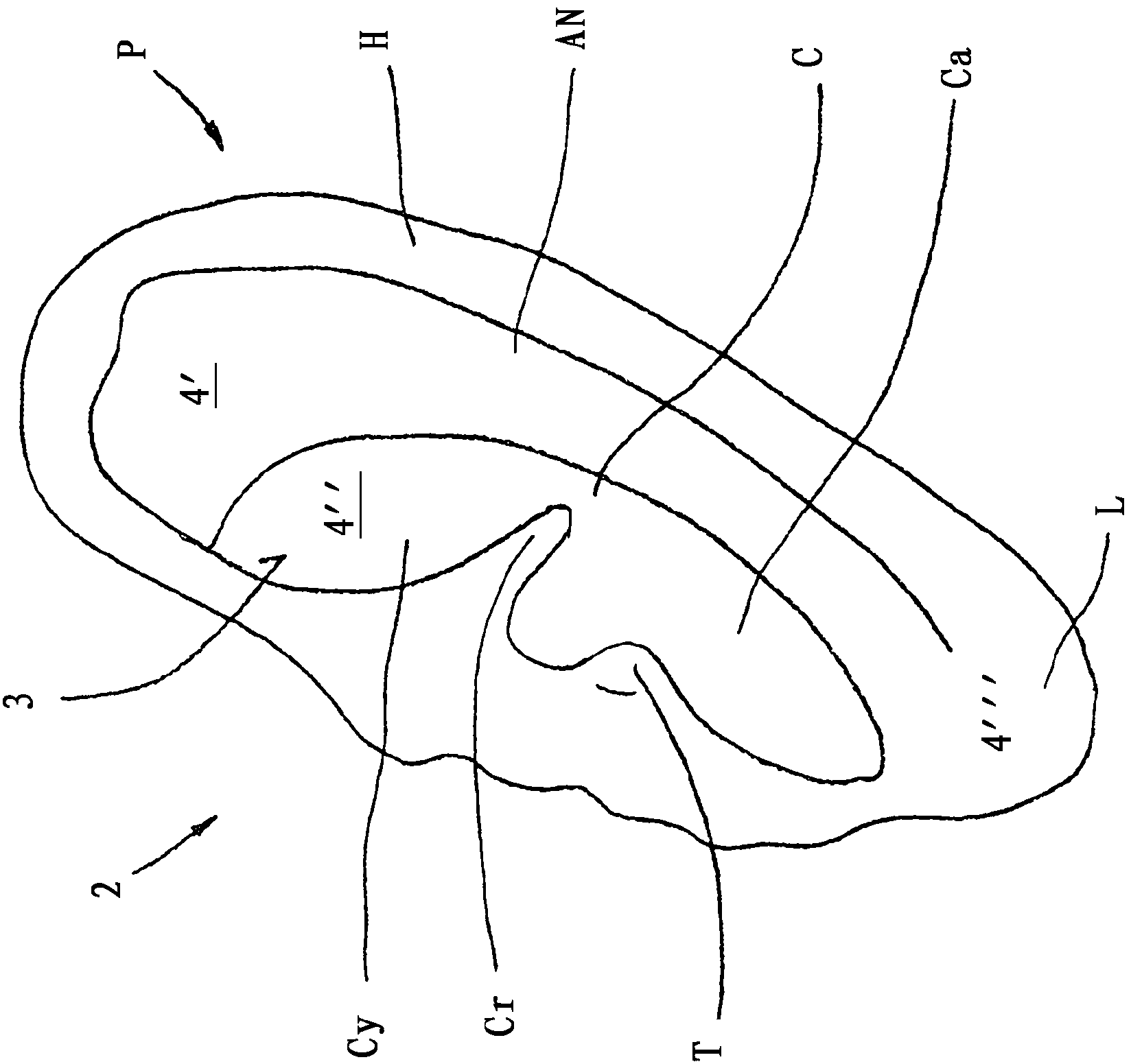 Electrode arrangement