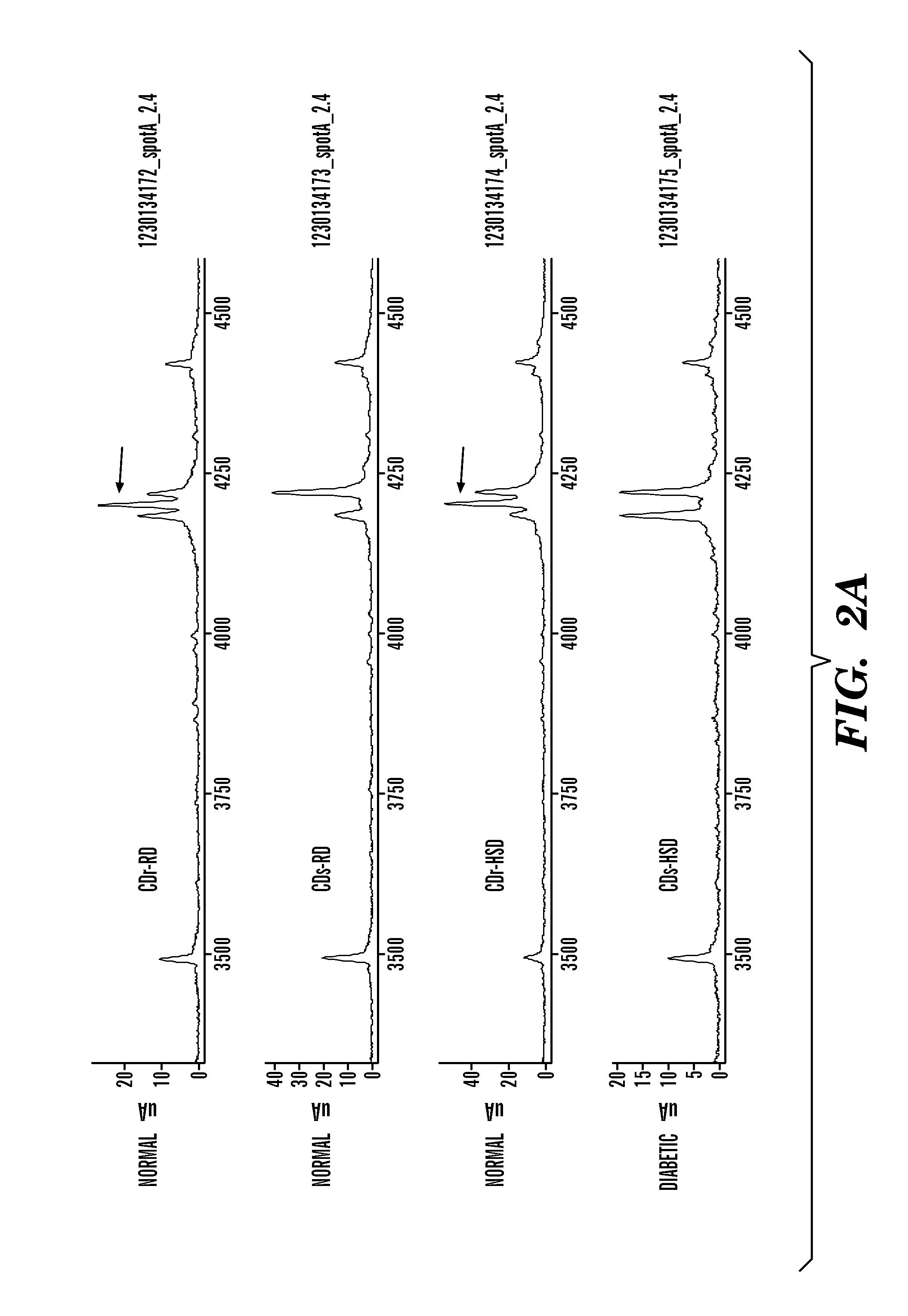 Compositions and methods for diagnosis and treatment of type 2 diabetes