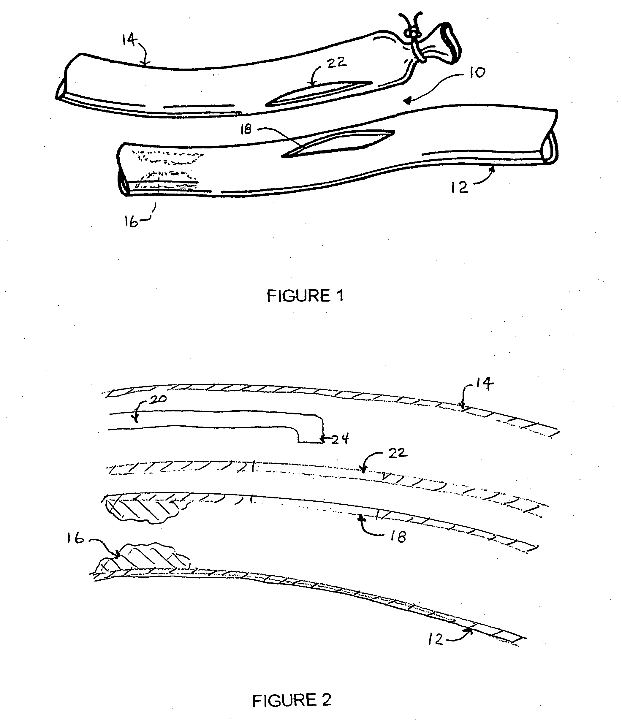 Anastomosis device and method