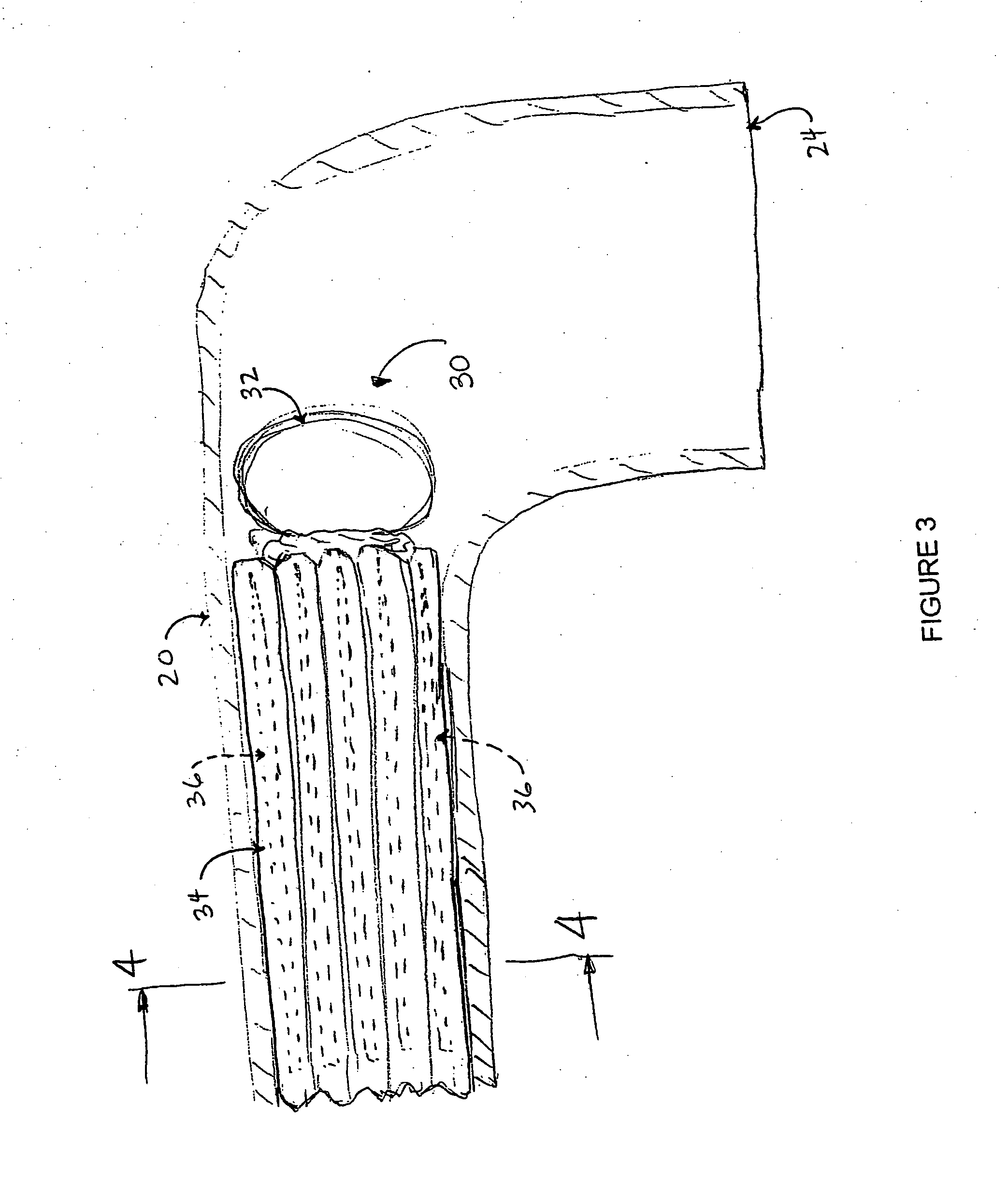 Anastomosis device and method