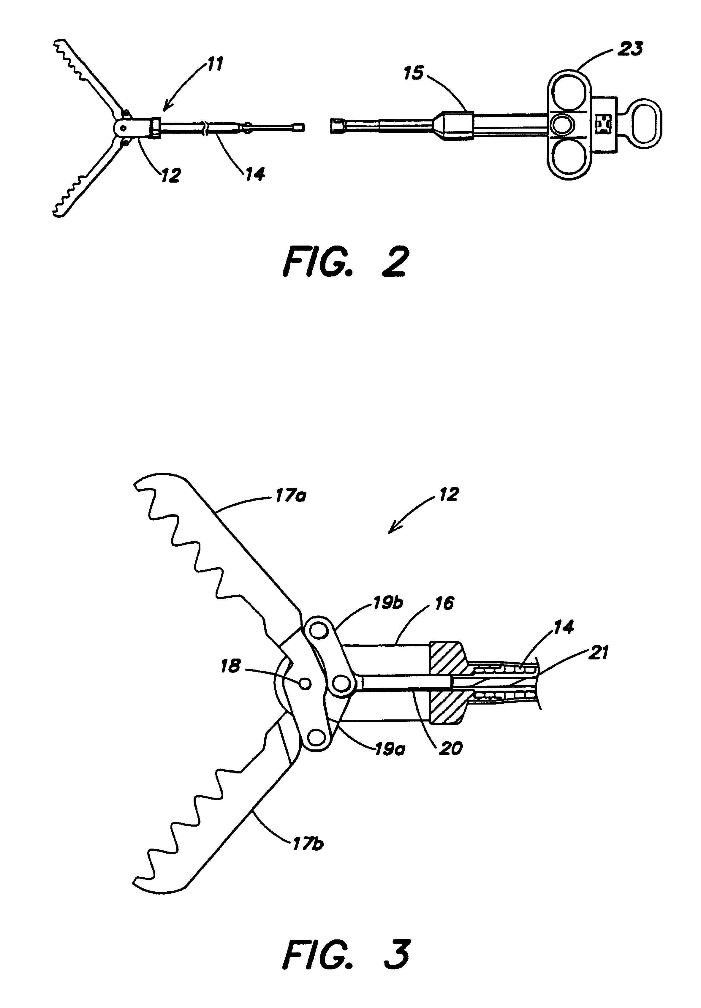 Endoscopic method for forming an artificial valve